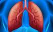 Cells damaged by chronic lung disease can result in severe Covid