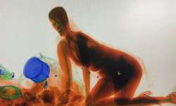 Chinese woman crawls into X-ray machine to protect her